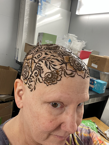Vassar Brothers Medical Center breast cancer patient Linda Deserto has a henna tattoo on her head after losing her hair from chemotherapy to treat breast cancer. 