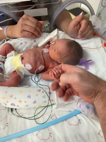 A preemie lays in an incubator hooked up to wires.