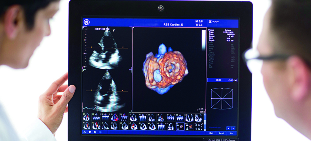 3D cardiac scans
