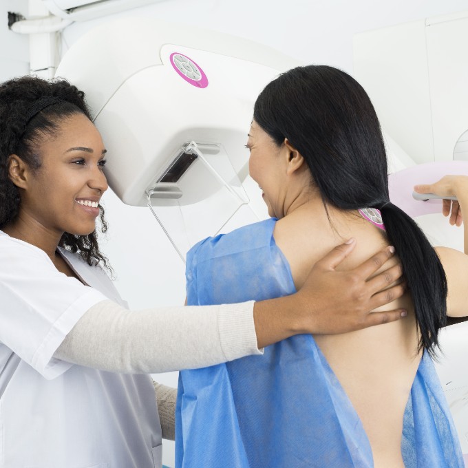 3D Mammography (Breast Tomosynthesis)