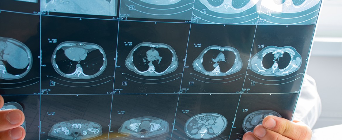 Chest CT of patient