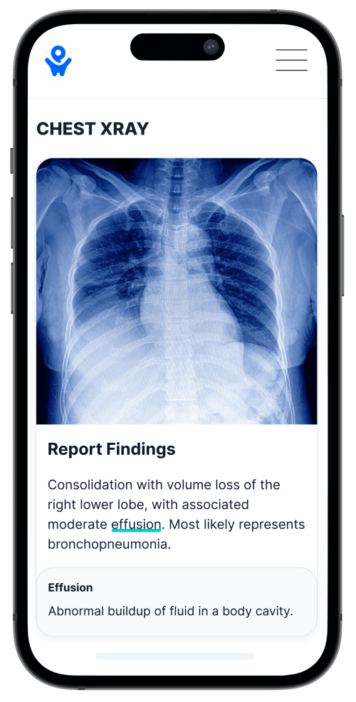 PocketHealth Image_ChestXray_Report_no background