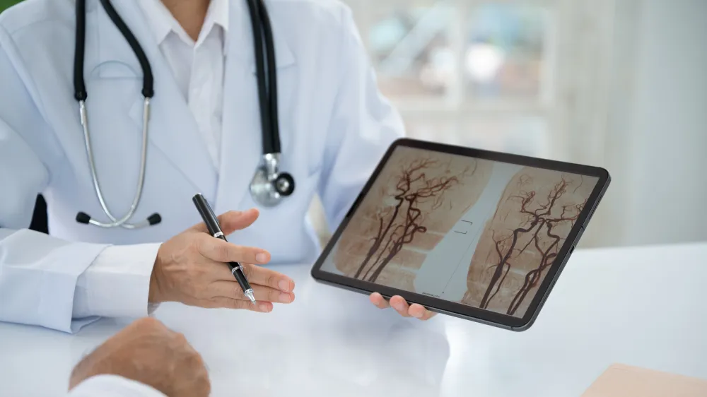 Neurosurgeon discussing cerebral blood vessel x-ray image with a colleague. Arteriovenous malformations are a type of cerebrovascular condition.