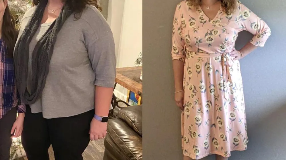 Article - Erin DeProspero Bariatrics PH June 2021