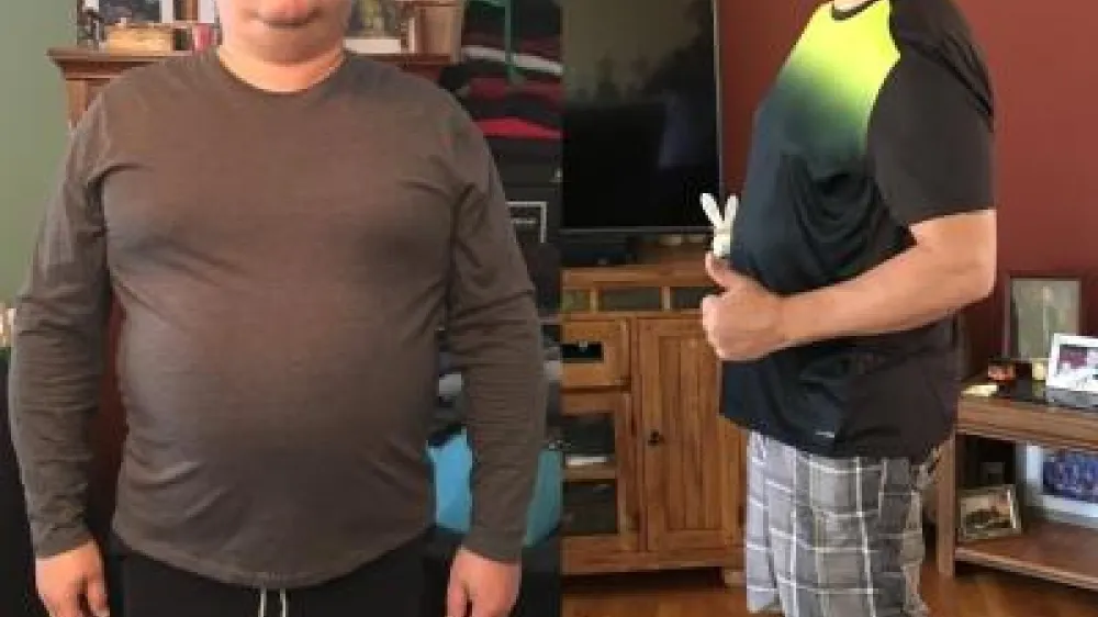 Article - John Crecco PH Bariatrics before and after photo
