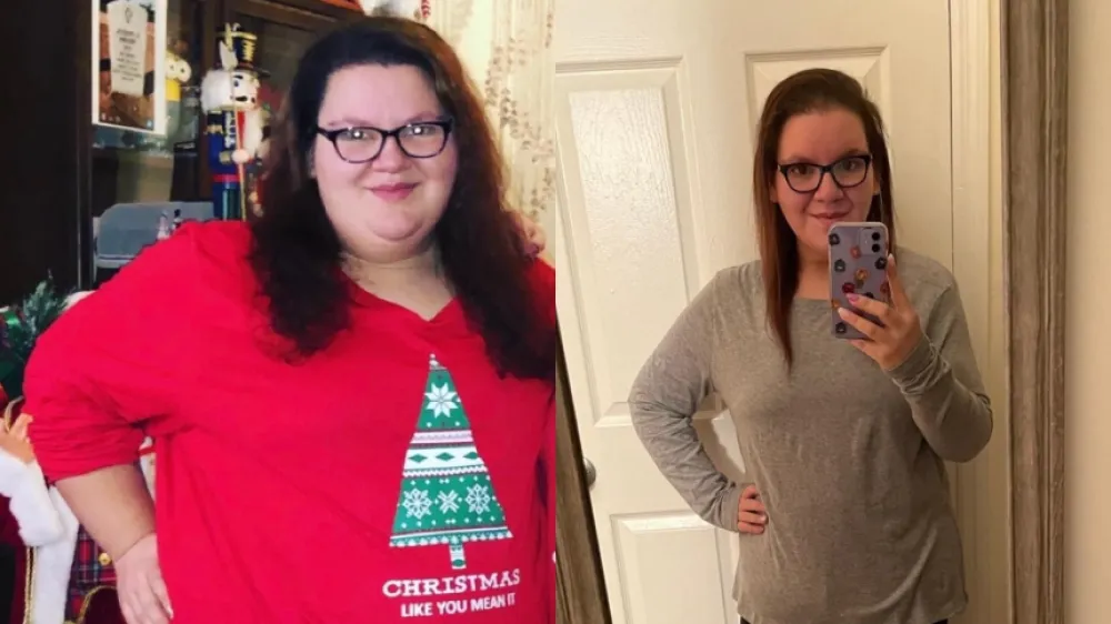 Elizabeth Miranda NDH Before and After 860x484
