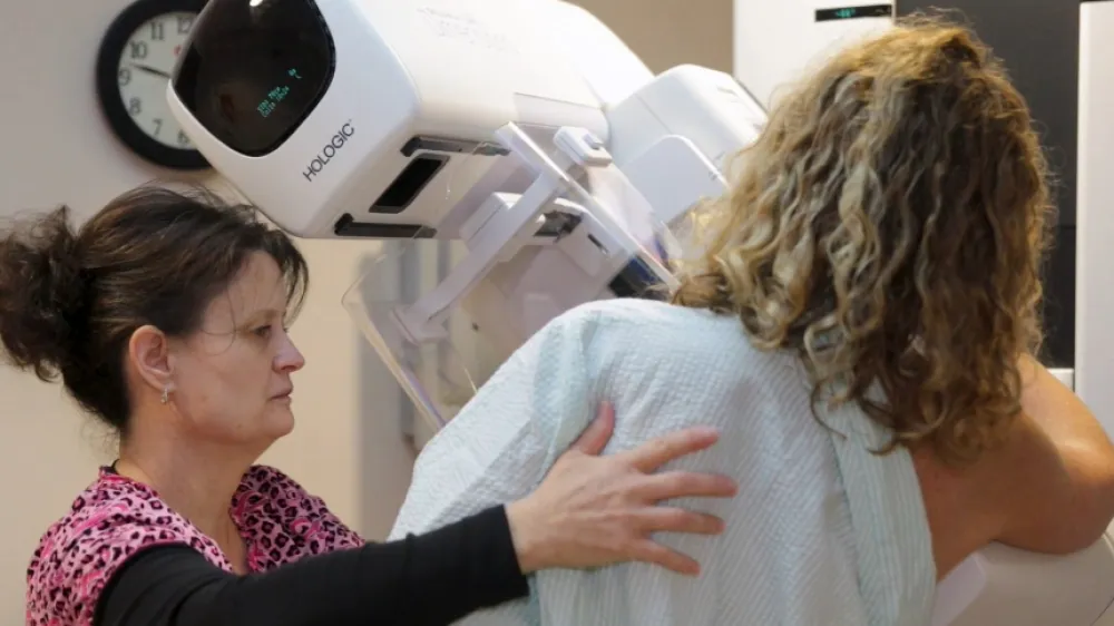 Hero Screening Mammogram Article 2023