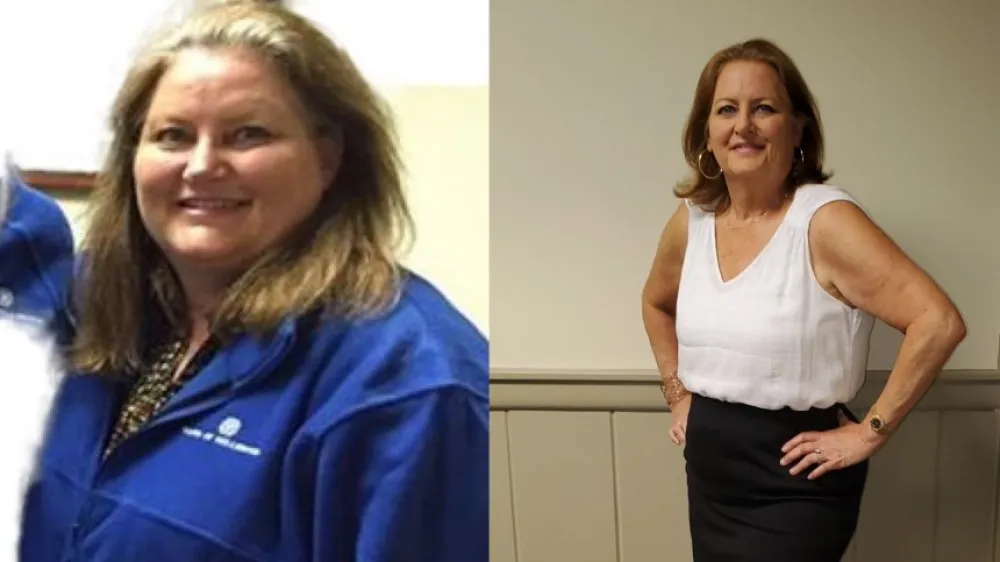 Susan Marshall Putnam Bariatrics June 2021 Crop