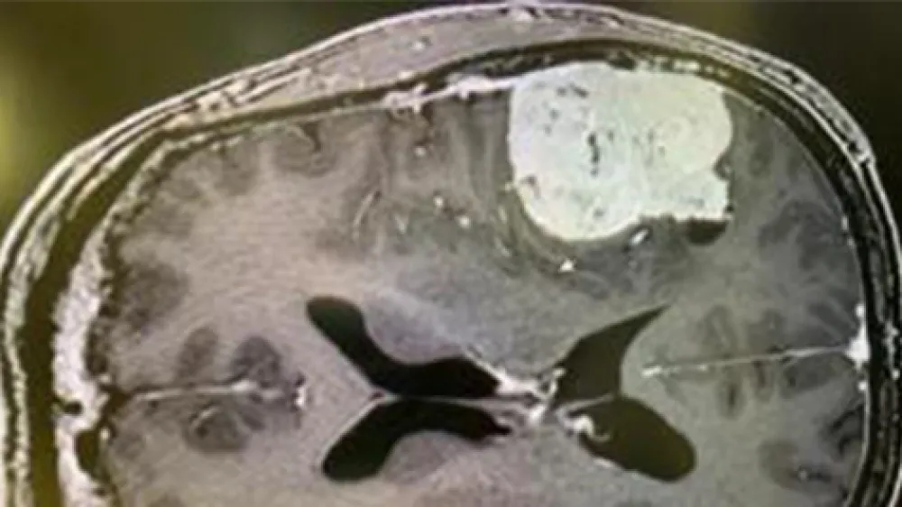 article-brain-scan