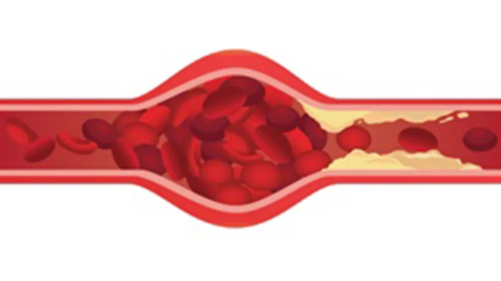 article-cholesterol