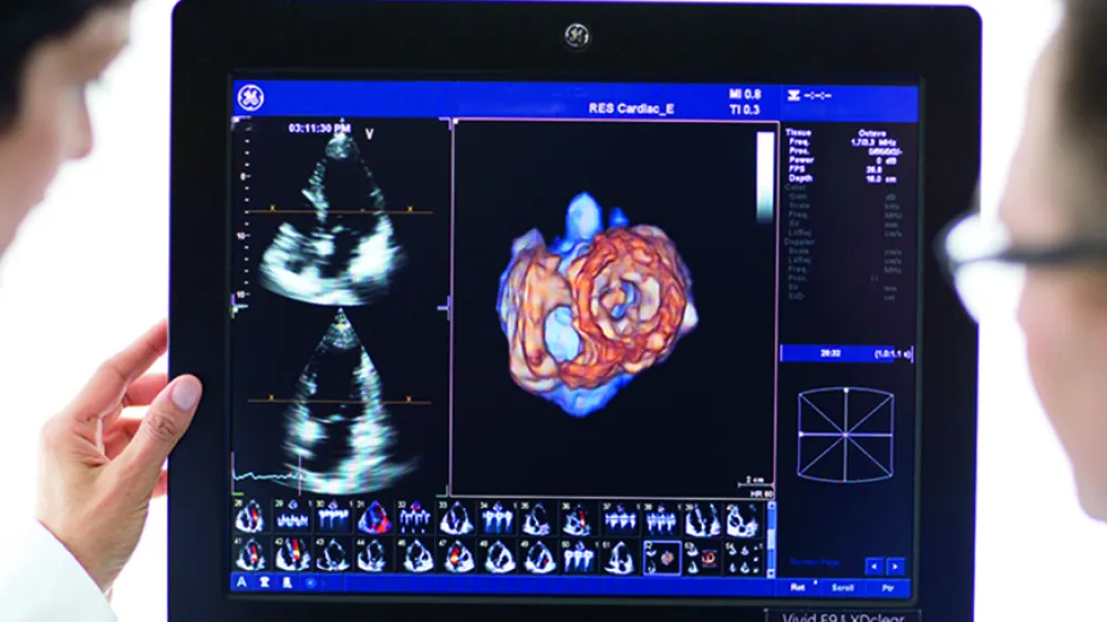 3d-cardiac-scan-techs