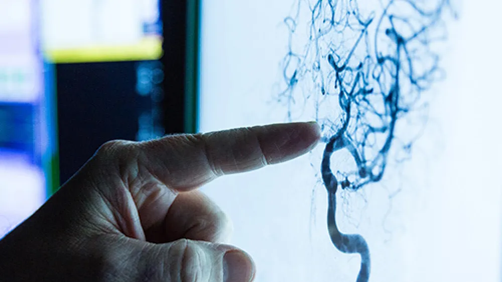 neurosciences-imaging-close-up-finger